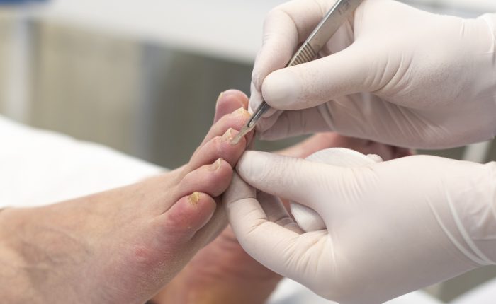 Voetcentrum-Dordrecht-pedicure-dordrecht-2594-3